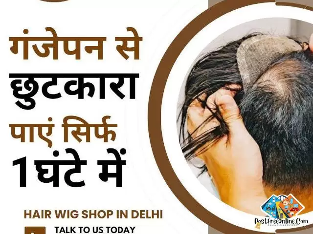 Hair Wig Shop in Delhi - Get rid of baldness in just 1 hour - 1